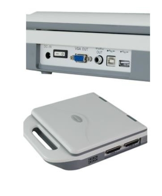 Stockage portatif d'images de la machine 12.1in LED 128 d'ultrason de gynécologie de Digital OB