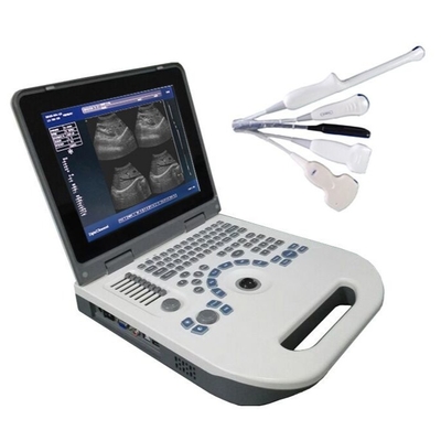 Scanner d'ultrason de carnet de contrôle de TGC pour l'usage à la maison de grossesse