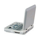 Machine d'échographie portable à couleur LED de 15 pouces avec angle de balayage de 60 degrés et affichage de profondeur ≥ 250 mm