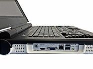 Appareil d'échographie portable couleur LED 15 pouces avec angle de balayage de 60 degrés et sonde de configuration 2,0 MHz-5,0 MHz