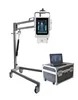 STXR-Y300 Machine de radiologie médicale portable aux rayons X équipée d'un écran tactile de 10,4 pouces