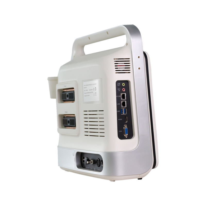 L'ultrason de Doppler de couleur de 15 pouces LED usine l'angle du balayage 60deg