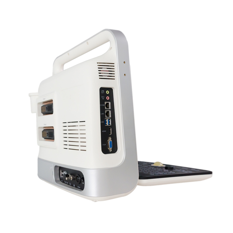 L'ultrason de Doppler de couleur de 15 pouces LED usine l'angle du balayage 60deg