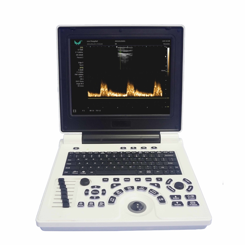 Machine portative d'ultrason de Doppler de couleur d'OB GYN dans la grossesse