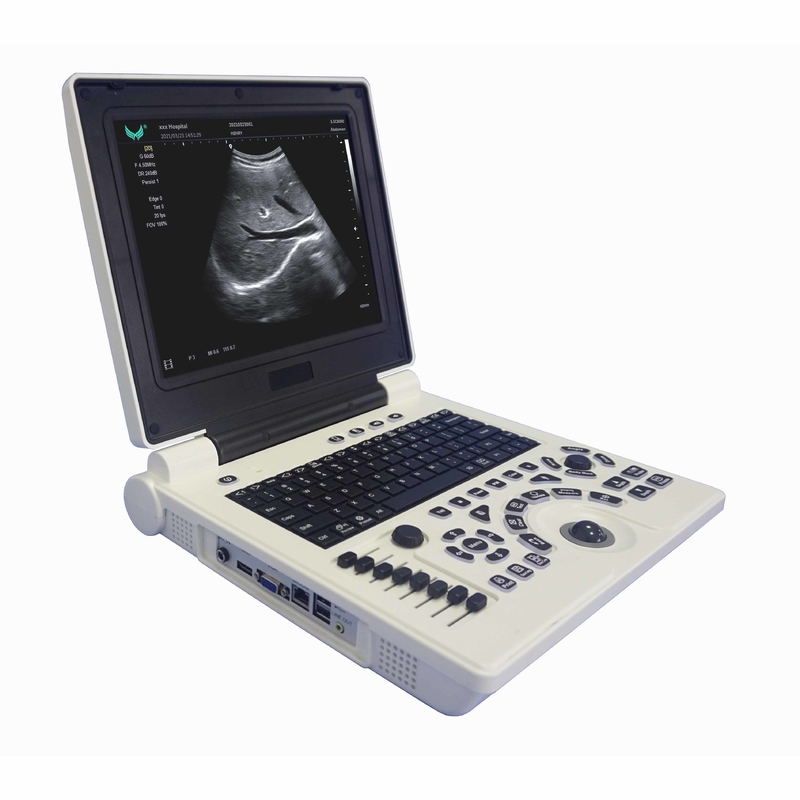 Machine portative d'ultrason de Doppler de couleur d'OB GYN dans la grossesse