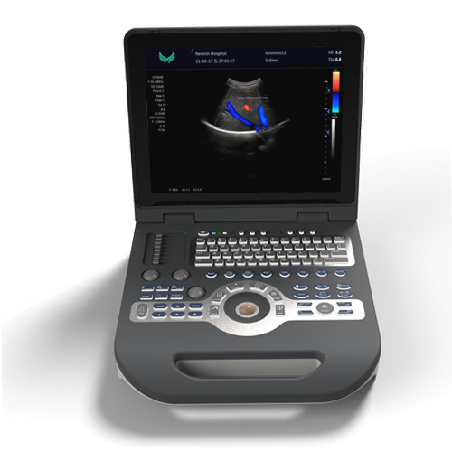 Dispositif tenu dans la main d'ultrason du scanner 220V Doppler d'ultrason de couleur de cardiologie de GV