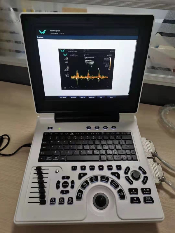 L'ultrason de Doppler de couleur de grossesse de Xianfeng usine l'OEM des images 4B