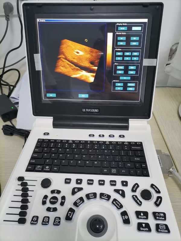 L'ultrason de Doppler de couleur de grossesse de Xianfeng usine l'OEM des images 4B