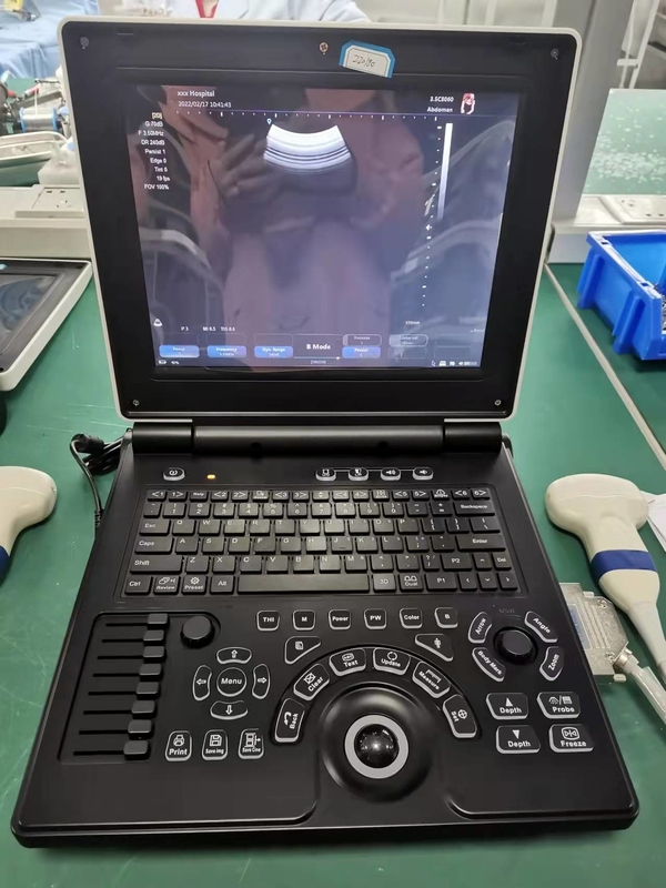 Système portatif d'ultrason de Doppler de couleur de Digital de machine du niveau de base USG d'OIN