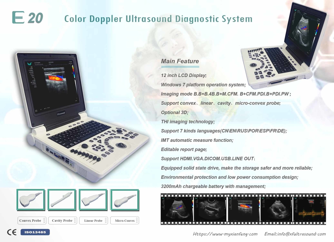 Système portatif d'ultrason de Doppler de couleur de Digital de machine du niveau de base USG d'OIN
