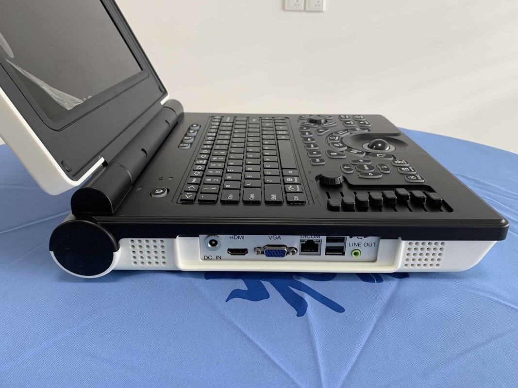 Batterie portative du scanner 3200mAh d'ultrason de Doppler de couleur du système Win7