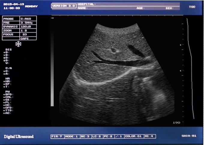 Machine portative DRF RDA 6 d'ultrason de vétérinaire équin universel