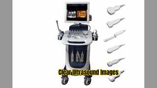 Mode PDI du scanner à ultrasons Doppler PW CFM