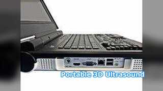 Hôpital clinique portatif de l'ultrason E20