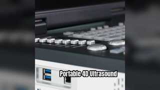 Machine portative à ultrasons Doppler 4D prête pour les soins intensifs