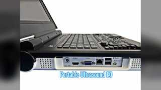 Balayage portatif d'urologie de l'échographie E0 de Doppler couleur