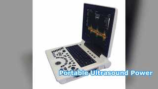 Diagnostic portatif d'OB GYN de machine d'ultrason